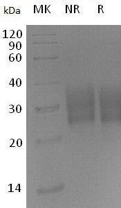 Mouse Tgfbr2 (His tag) recombinant protein