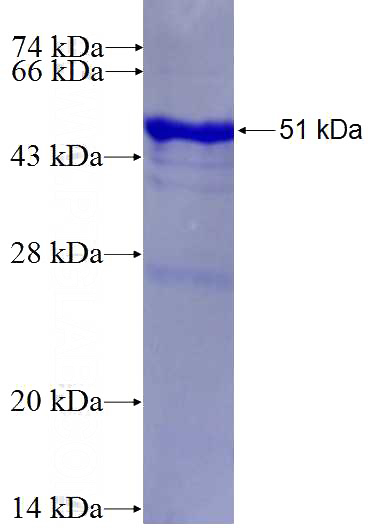 Recombinant Human TTN SDS-PAGE