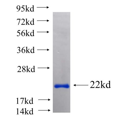 Recombinant human CHRFAM7A SDS-PAGE