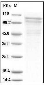 Human R-Cadherin / CDH4 Protein (His Tag) SDS-PAGE