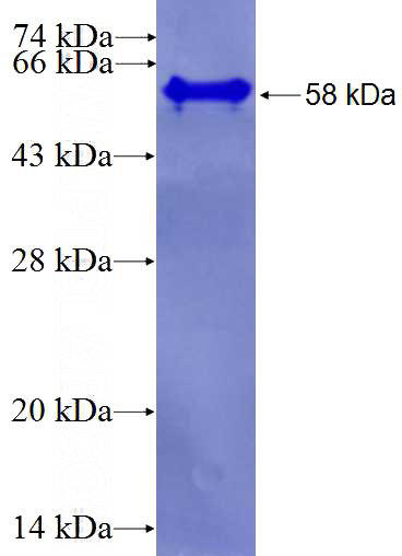 Recombinant Human WDR42A SDS-PAGE