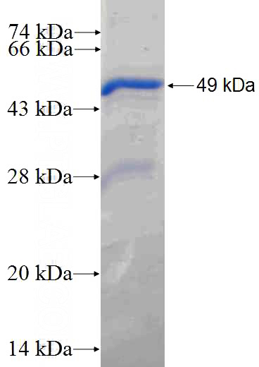Recombinant Human PPM1D SDS-PAGE