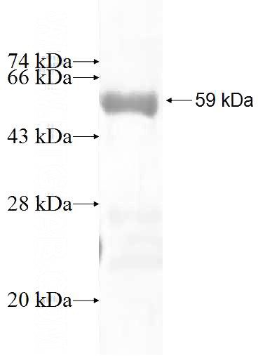 Recombinant Human CPNE6 SDS-PAGE