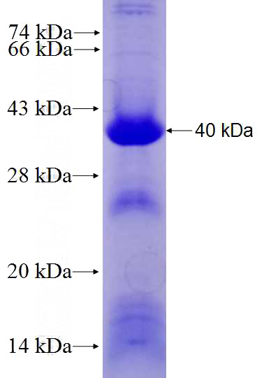 Recombinant Human UMOD SDS-PAGE