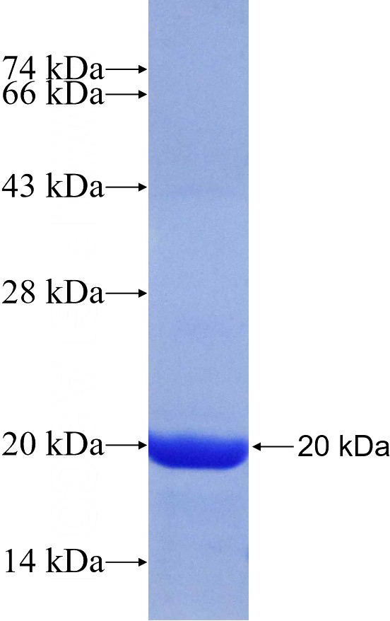 Recombinant Human RPS10 SDS-PAGE