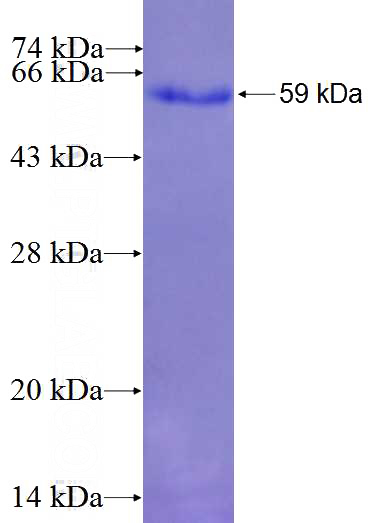 Recombinant Human CLINT1 SDS-PAGE