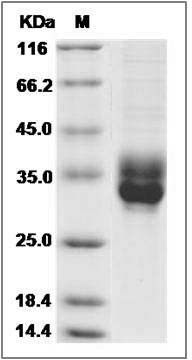 Rat CLEC4B2 / mDCAR1 Protein (His Tag) SDS-PAGE