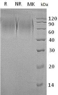 Human MUC15/UNQ750/PRO1481 (His tag) recombinant protein