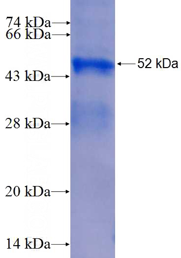 Recombinant Human EEF1G SDS-PAGE