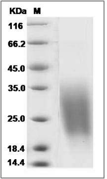 Human CREB3L1 / OASIS Protein (aa 396-519, His Tag) SDS-PAGE