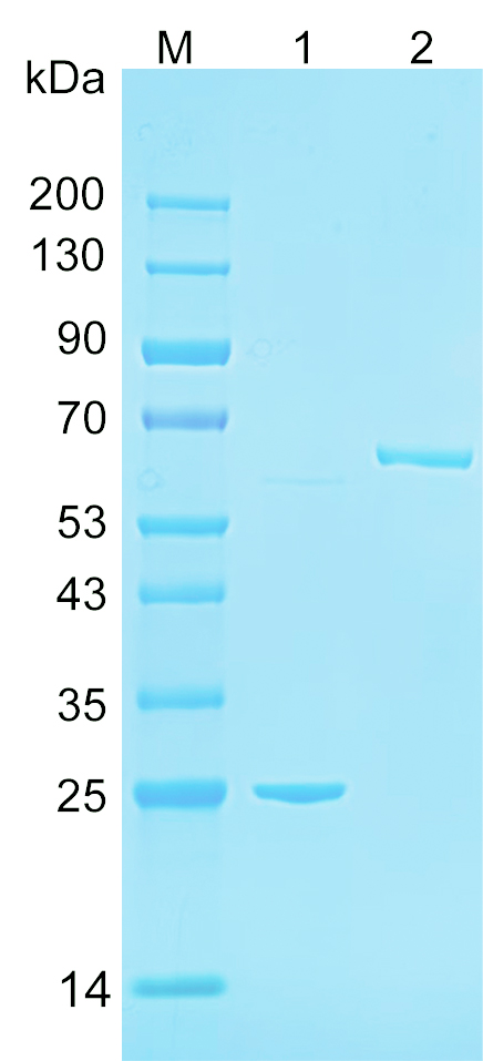 Recombinant NPS3B protein (His tag) SDS-PAGE