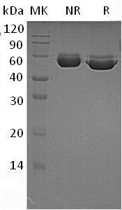Human CTSA/PPGB (His tag) recombinant protein