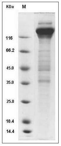 CMV Glycoprotein B / gB Protein (Fc Tag) SDS-PAGE