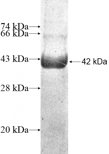 Recombinant Human OGDHL SDS-PAGE