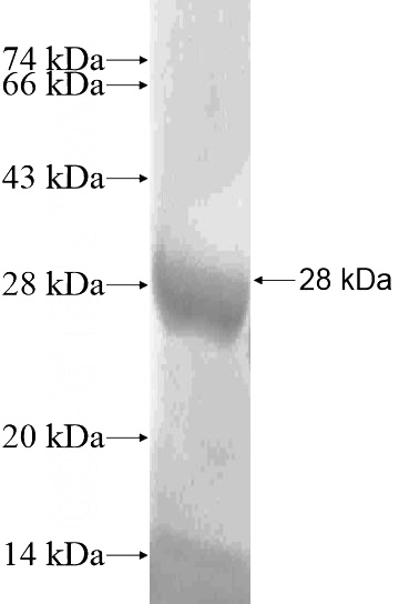 Recombinant Human C12orf72 SDS-PAGE
