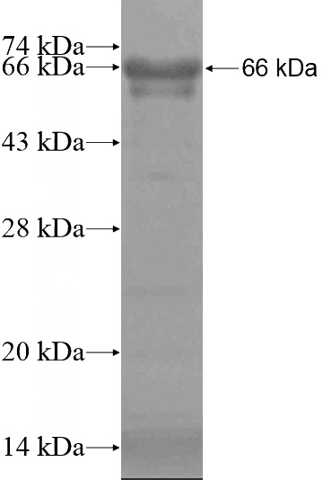 Recombinant Human ZCCHC8 SDS-PAGE