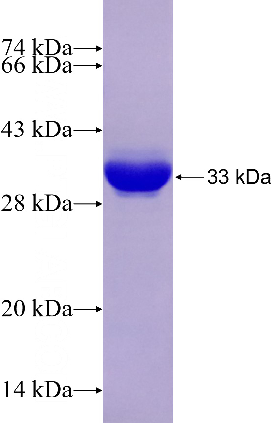 Recombinant Human UCK2 SDS-PAGE