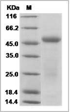 Human IL17B / IL-17B Protein (Fc Tag)