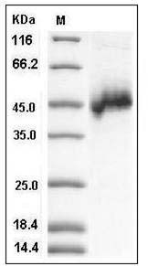 Human NETO1 / BTCL1 Protein (His Tag) SDS-PAGE