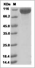 Cynomolgus / Rhesus IL21R / IL-21R Protein (Fc Tag) SDS-PAGE
