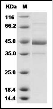 Novel coronavirus (HCoV-EMC/2012) Spike Protein fragment (aa 383-502, Fc Tag) SDS-PAGE