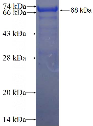 Recombinant Human LRRCC1 SDS-PAGE