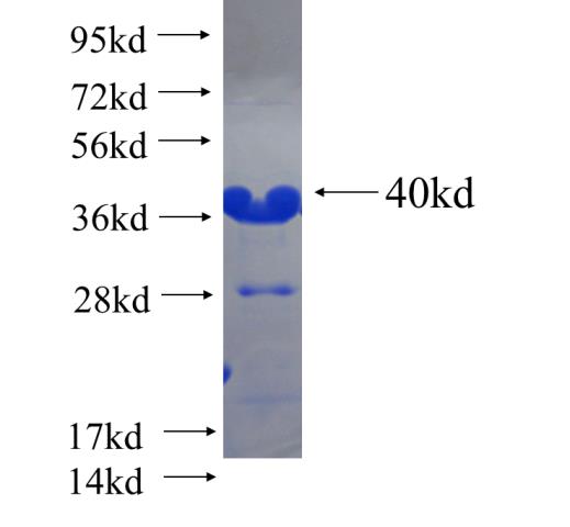 Recombinant human CLTB SDS-PAGE