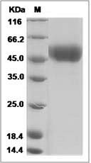 Influenza A H6N2 (A/duck/Shantou/83/2000) Hemagglutinin / HA1 Protein (His Tag)