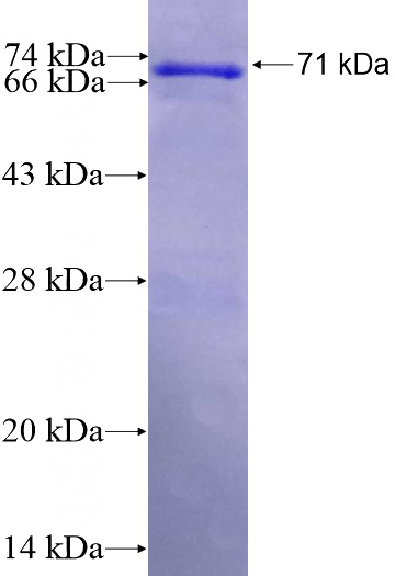 Recombinant Human SPOPL SDS-PAGE