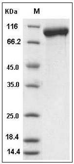Mouse LRIG1 / LIG-1 Protein (His Tag) SDS-PAGE