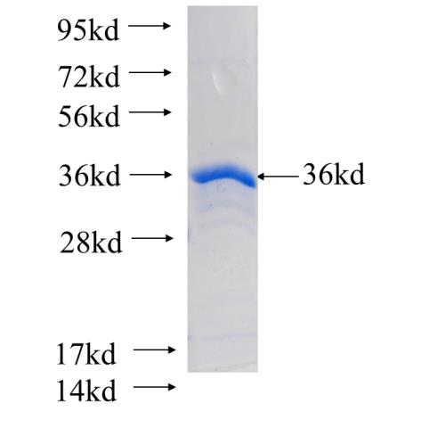 Recombinant human FIT1 SDS-PAGE