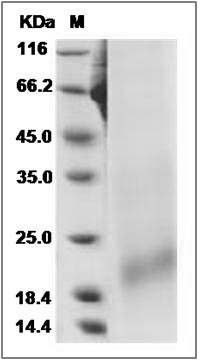 Rat BAFFR / TNFRSF13C Protein (His Tag) SDS-PAGE