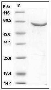 Human DNMT2 / TRDMT1 Protein (GST Tag) SDS-PAGE