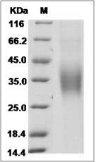 Hepatitis C virus Envelope Glycoprotein E1 / HCV-E1 (subtype 1b, strain HC-J4) Protein (His Tag)