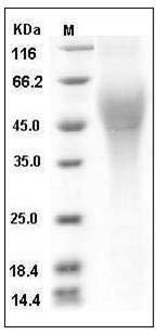 Human CD200R1L / CD200R2 / CD200RLa Protein (His Tag) SDS-PAGE