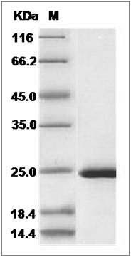 Human PPIL2 Protein (aa 280-457, His Tag) SDS-PAGE
