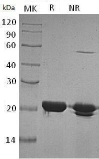 Human FTH1/FTH/FTHL6/OK/SW-cl.84/PIG15 (His tag) recombinant protein
