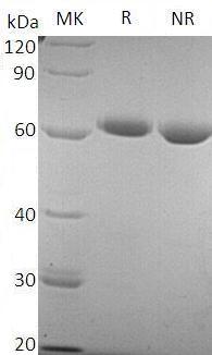 Human NT5E/NT5/NTE (His tag) recombinant protein