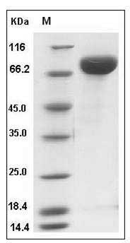 Influenza A H1N1 (A/Beijing/22808/2009) Hemagglutinin / HA Protein (His Tag) SDS-PAGE