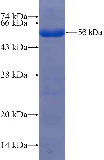 Recombinant Human SESTD1 SDS-PAGE