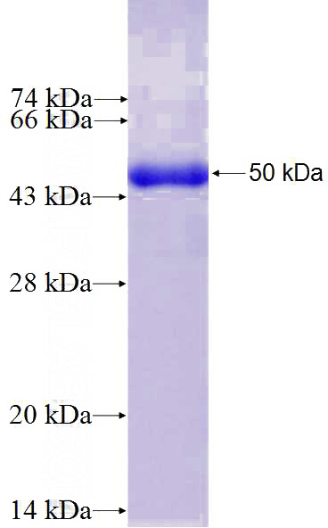 Recombinant Human MTSS1 SDS-PAGE