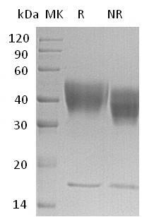 Human IFNGR1 (His tag) recombinant protein