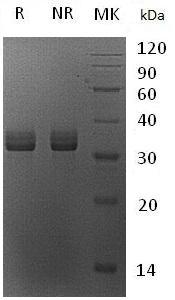 Human STX7 (His tag) recombinant protein