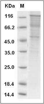 Rat Cadherin-15 / CDH15 Protein (Fc Tag) SDS-PAGE
