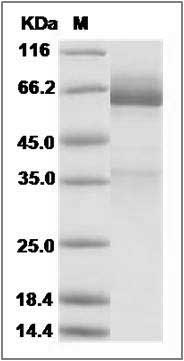 Mouse Glypican 3 / GPC3 / OCI-5 Protein (His Tag) SDS-PAGE