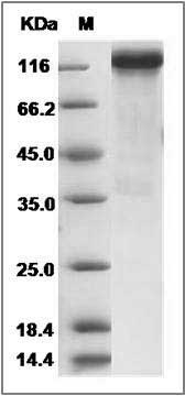 Rat HER4 / ErbB4 Protein (Fc Tag) SDS-PAGE