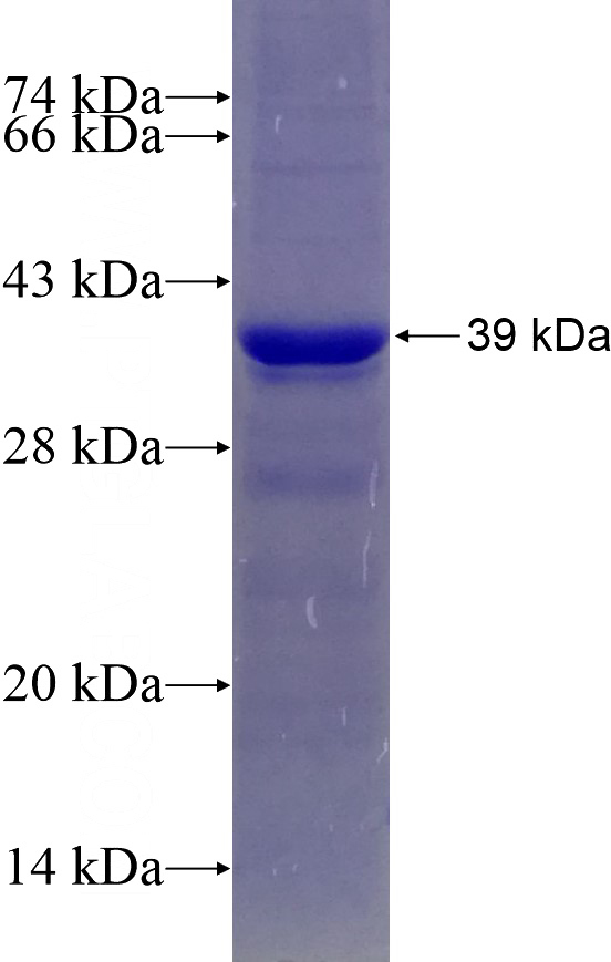 Recombinant Human APPBP2 SDS-PAGE