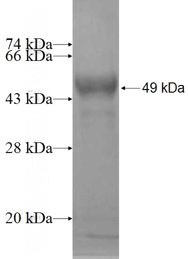 Recombinant Human ATP6V0A2 SDS-PAGE