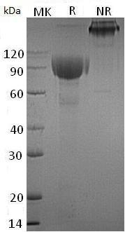 Human IL1RL2/IL1RRP2 (Fc tag) recombinant protein