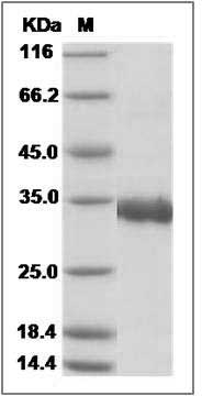 Human SARS Coronavirus Spike Protein (Receptor Binding Domain, His Tag) SDS-PAGE